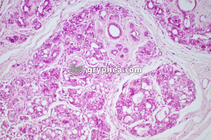 Glande mammaire active CT x40 - gryphea.com